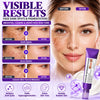 Nuvilo Advanced Anti-Hyperpigmentation Cream