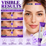 Nuvilo Advanced Anti-Hyperpigmentation Cream