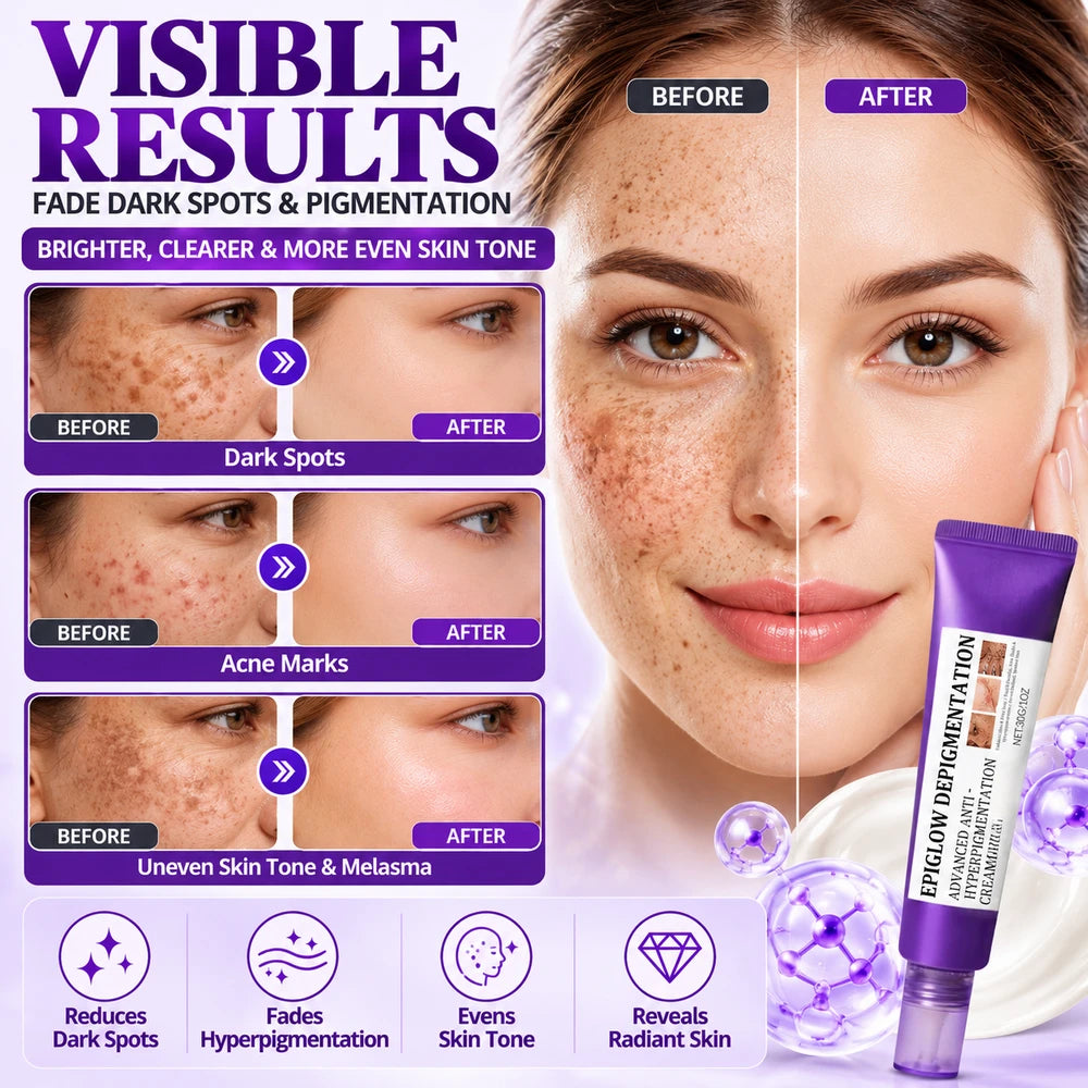 Nuvilo Advanced Anti-Hyperpigmentation Cream