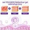 Regen Scar Repair Gel
