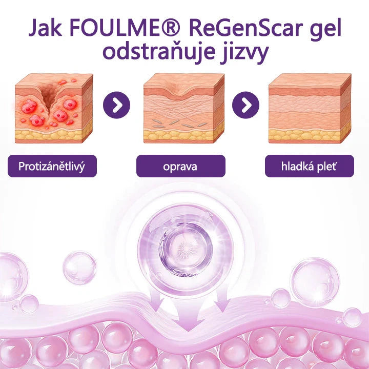 Regen Scar Repair Gel
