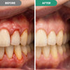 Dentora Advanced Gum Care Gel