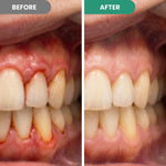 Dentora Advanced Gum Care Gel