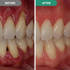 Dentora Advanced Gum Care Gel