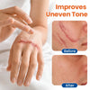 Skin Renewal Gel