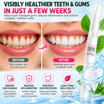 Sensitive Teeth Repair Gel