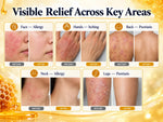Mirevane Skin Recovery Gel