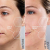 Revaskin At-Home Dermaplaning Device