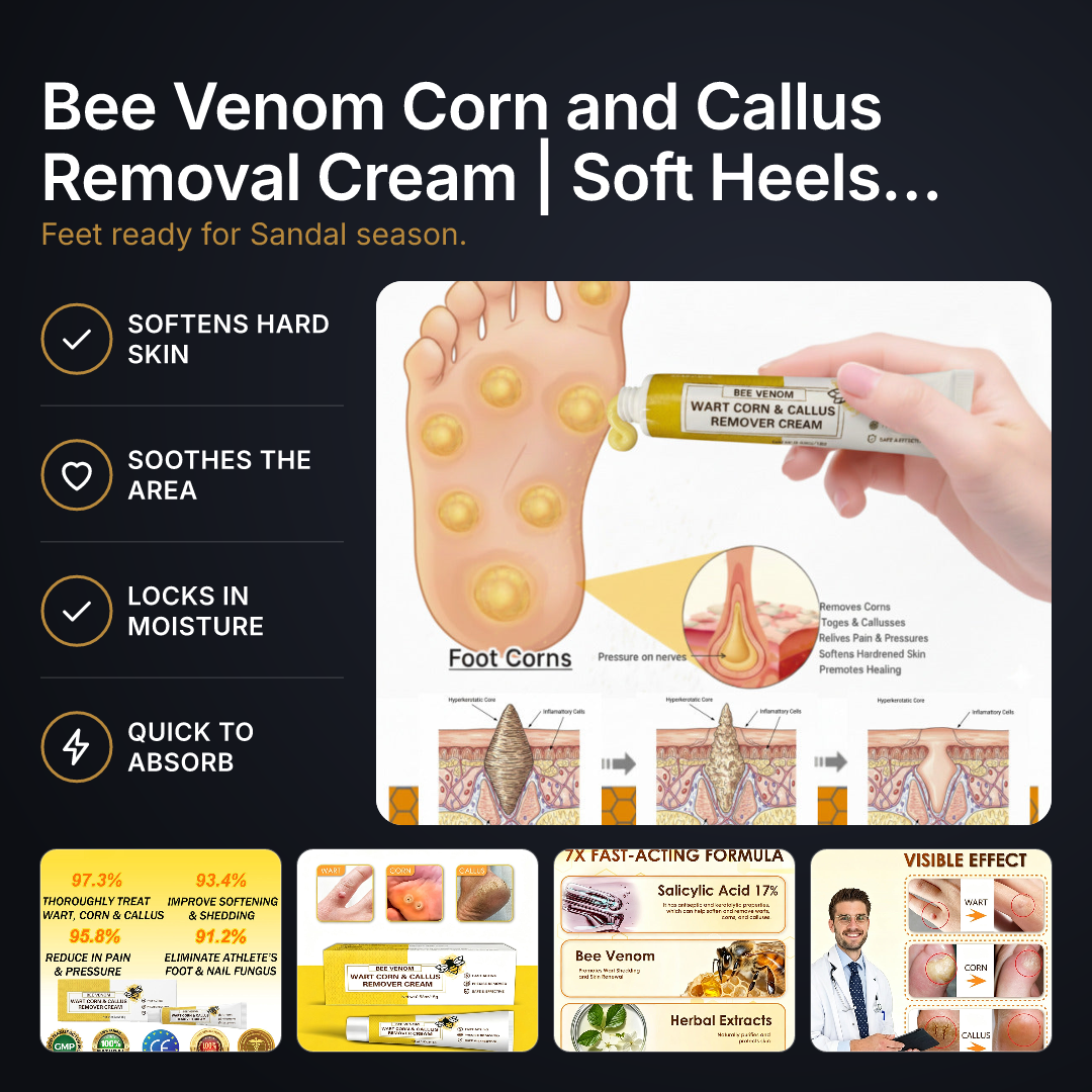 Bee Venom Corn and Callus Removal Cream | Soft Heels for Sandals